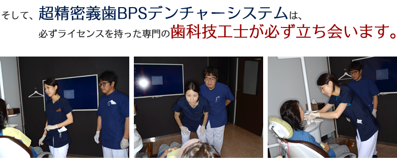 超精密義歯(入れ歯)について