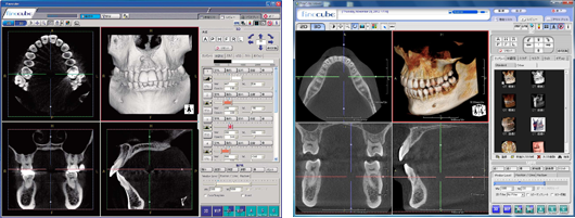 多治見市・美濃加茂市・土岐市で入れ歯・義歯は可児市おくだ歯科へ